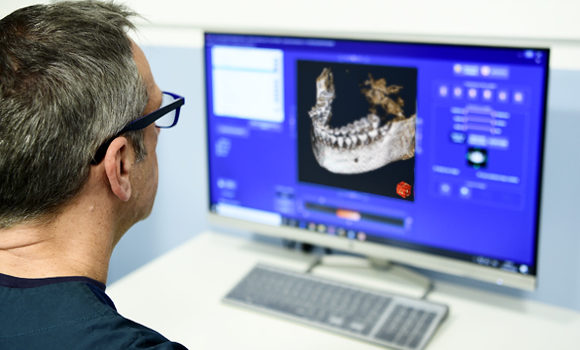 studio-dentistico-ballone-vomero-napoli-colli-aminei-rx-e-diagnostica-1